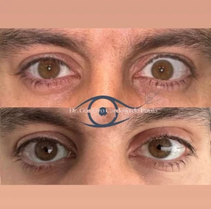 antes e depois - 25_1x