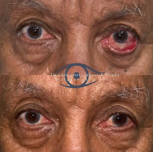 antes e depois - 26_1x