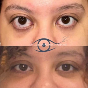 antes e depois - 28_1x