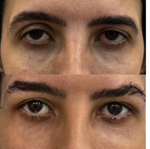 antes e depois - 29_1x