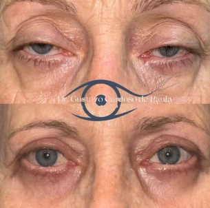 antes e depois - 30_1x