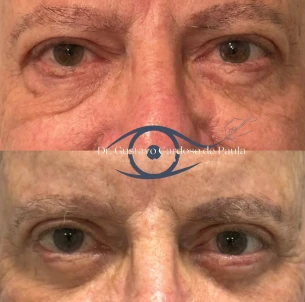 antes e depois - 31_1x